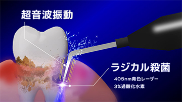 1.歯ぐきの奥の細菌にアプローチ