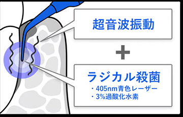 切らない治療