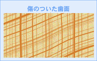 知っていますか？毎日の歯ブラシで歯に傷が！！